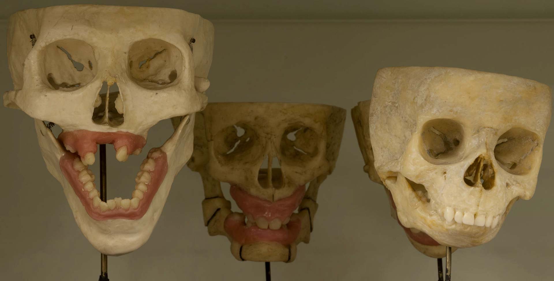 Skulls from the dentistry collection at Blythe House